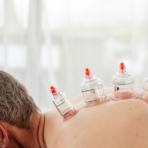 Cupping treatment